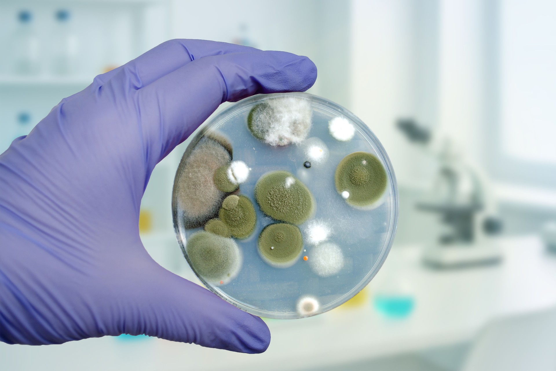 Mold fungi colonies grown from indoor air on potato dextrose agar